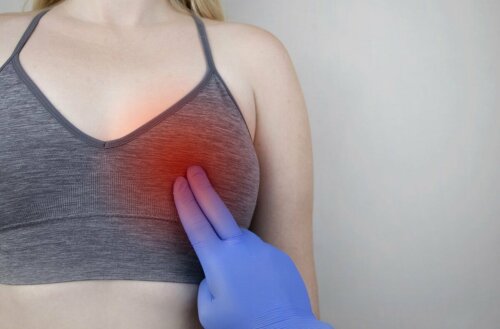 Mastitis führt zu Schmerzen an der Brust
