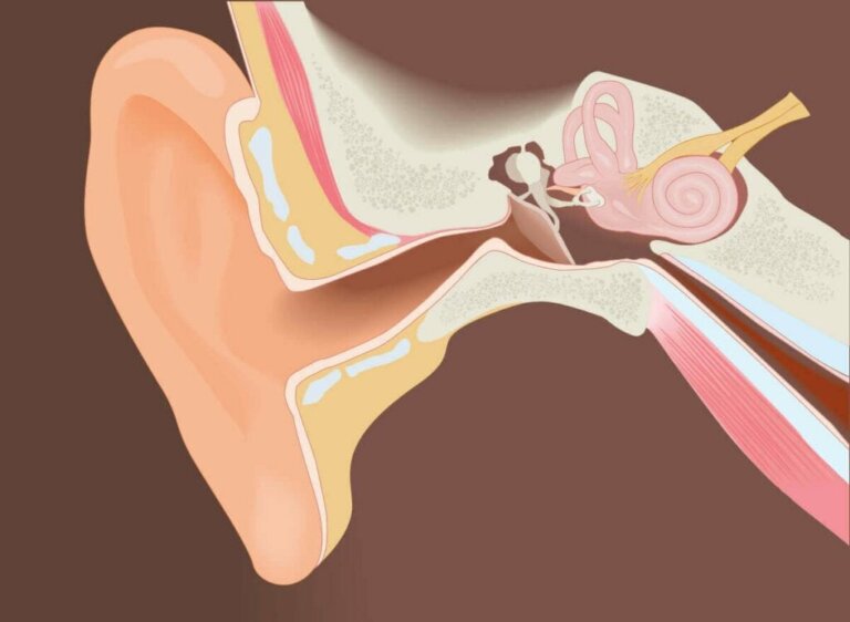 Operative Abtragung der Gehörgangsexostose