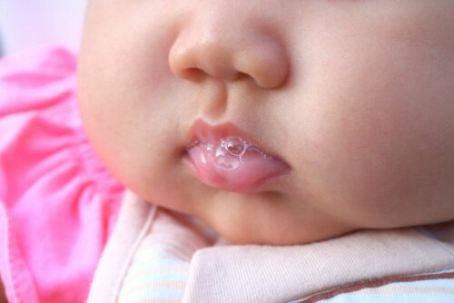 Sialorrhöe bei Babys