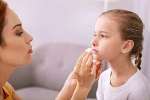 Nasenbluten bei Kindern und wie man es stoppt