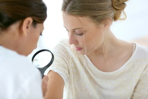 Leberfleck Haut gutartiger Tumor