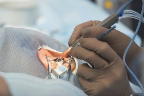 Operation Auge