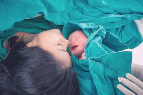 Frühgeborene - Mutter nach Kaiserschnitt