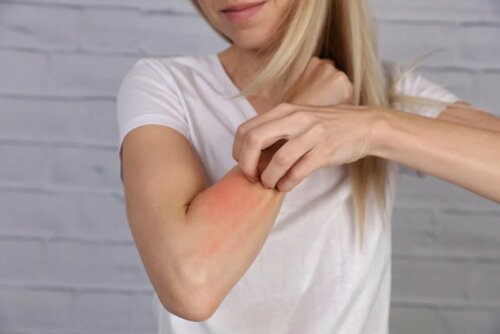 Allergie Dermatitis