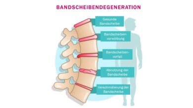 Bandscheibendegeneration: Symptome und Diagnose