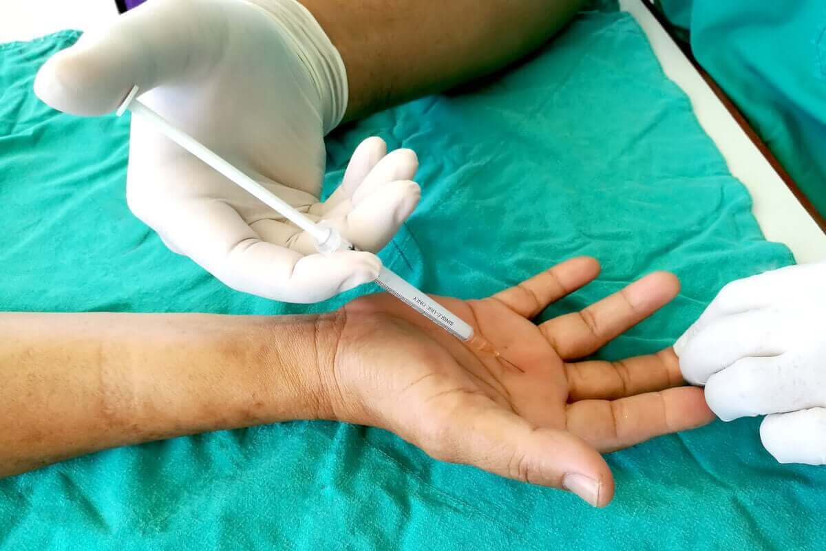Eine Behandlungsoption ist die Steroidinjektion
