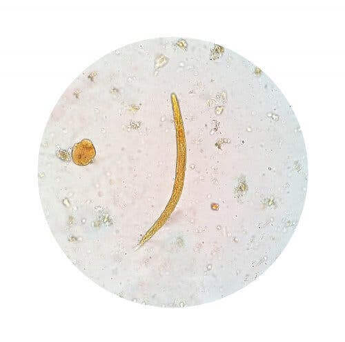 Kryptosporidiose - Parasit unter dem Mikroskop