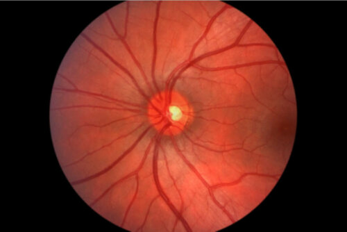 Auge von Innen