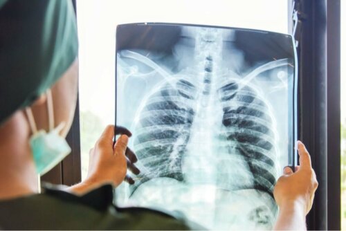 Lunge vor Lungentransplantation