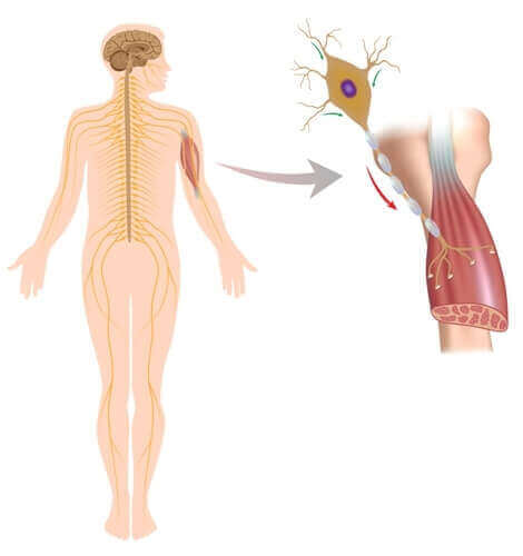 Eine Grafik mit einer Nahaufnahme der Auswirkungen auf die Muskeln bei neuromuskulären Erkrankungen