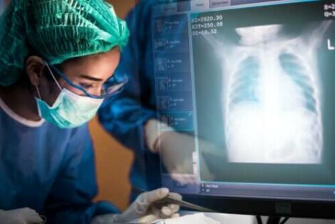 Lungentransplantation: Wissenswertes