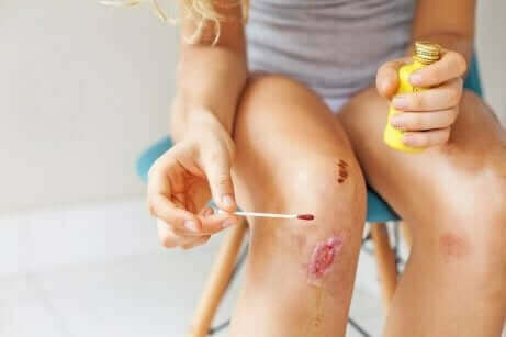 Eine Person, die einen Schnitt am Knie reinigt, um eine infizierte Wunde zu behandeln.