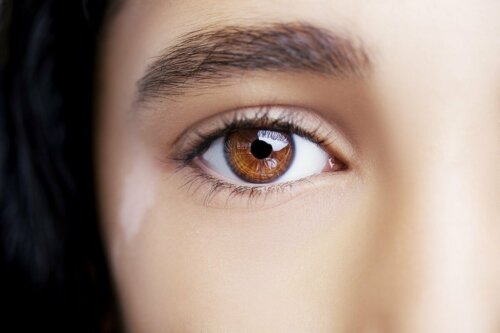 Vitiligo kann auch auf den Augenlidern vorkommen
