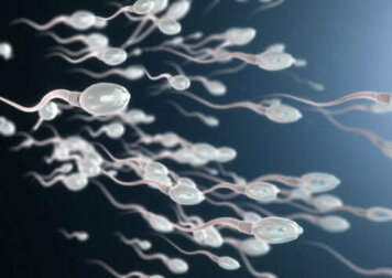 Erfahre alles über Asthenozoospermie