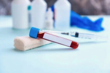 Erythrozytensedimentationsrate - Was ist das?