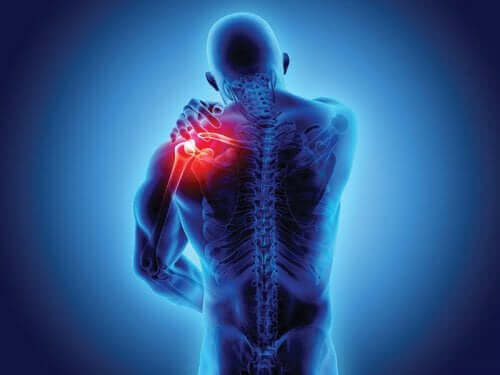 Spondyloarthropathien: Wissenswertes