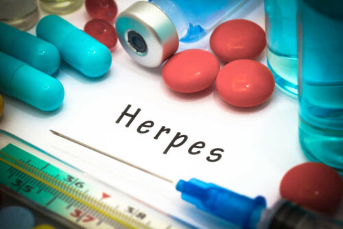 Herpes-Behandlung