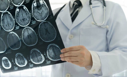 Arzt beim Betrachten von Gehirn-Scans