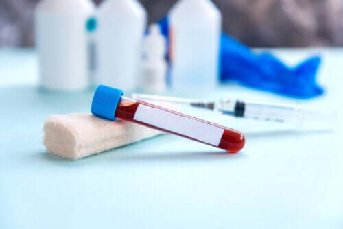 Blutsenkung: Wie wird die Erythrozytensedimentationsrate (ESR) bestimmt?