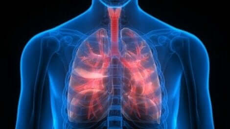 Thromboembolie