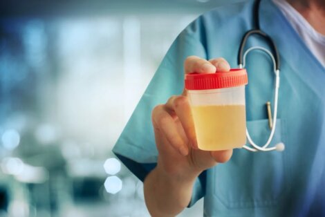 Urinkultur: Was ist das und wozu dient sie? - Besser Gesund Leben