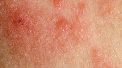 Essig mit Bleichmittel