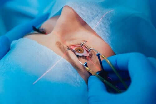 skleraeindellende Operation