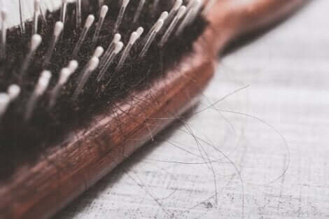 postpartale Alopezie
