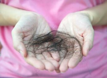 Was weißt du über postpartale Alopezie?