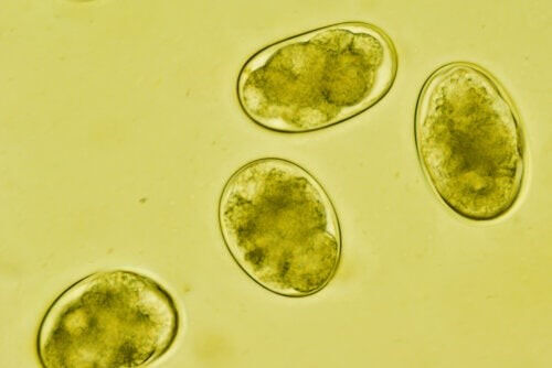 Was ist Strongyloidiasis und wie steckt man sich damit an?