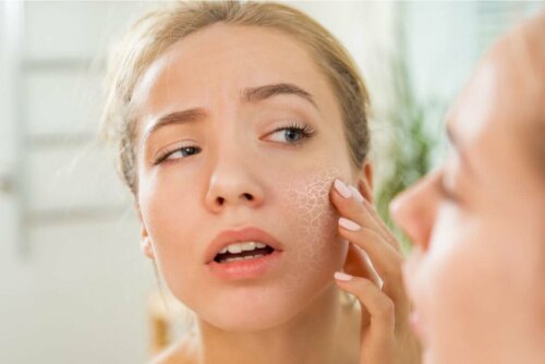 Peptide - Frau mit trockener Haut