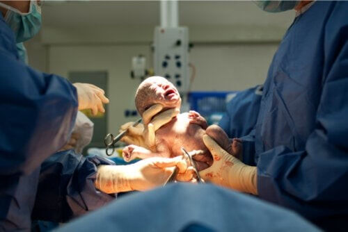 Ist eine natürliche Geburt nach einem Kaiserschnitt ratsam?