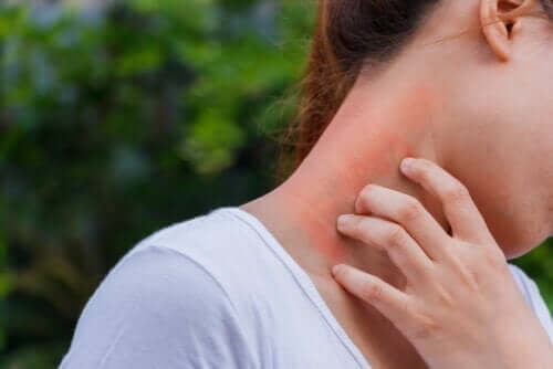 Dermatitis und Kortikosteroide: Wie hängen sie zusammen?