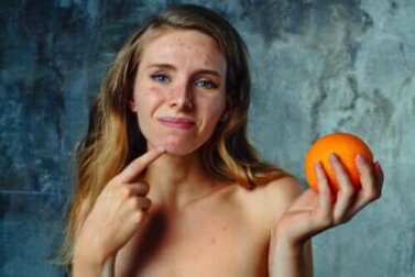 Zitrusfrüchte-Allergie: Symptome, Behandlung und Empfehlungen