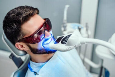 Zahnbleaching: Wie lange hält es?
