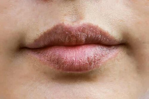 Lanolin - trockene Lippen
