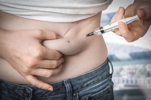 Insulinpumpen stellen eine Alternative zu Insulinspritzen dar