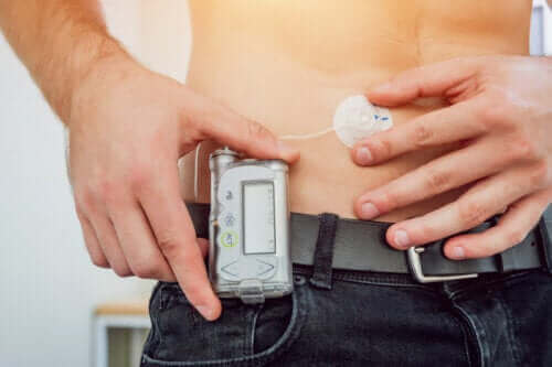 Insulinpumpen zur Behandlung von Diabetes