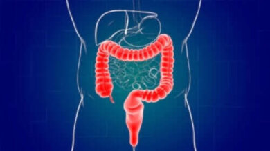 Proktitis Ursache und Behandlung Besser Gesund Leben