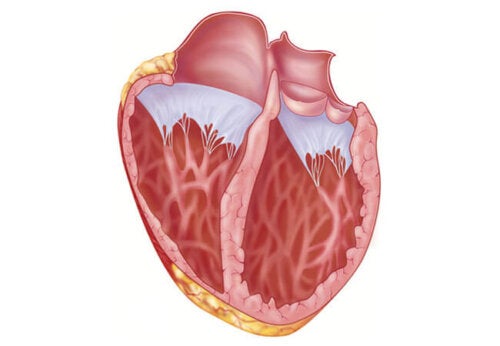 Erweiterung des Herzmuskels: Was du darüber wissen solltest