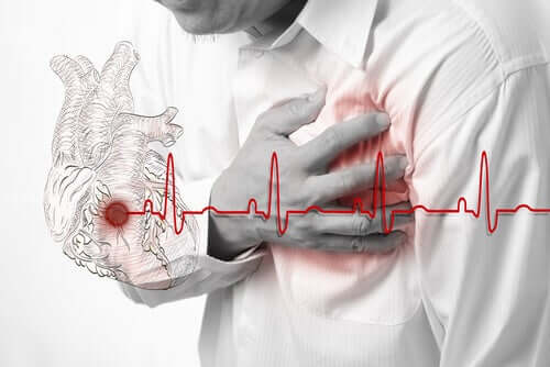 Falscher Herzinfarkt und wie man ihn erkennt