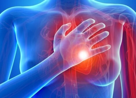 Herzerkrankungen bei Frauen und die Symptome