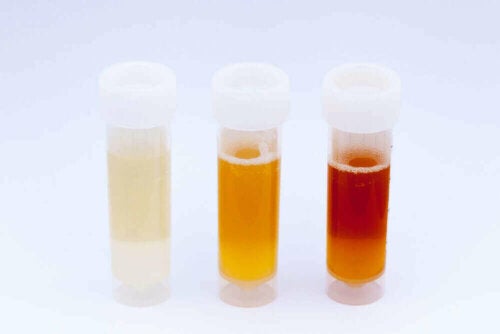 Ph test urin - Der TOP-Favorit unserer Produkttester