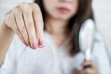Was kann man bei Haarausfall tun?