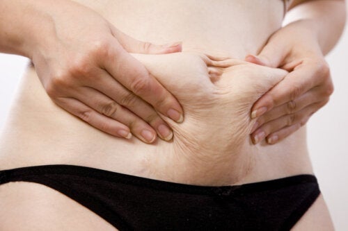 "Mommy Makeover" - was ist das?