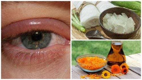 Augeninfektion lindern mit einem dieser 9 Heilmittel