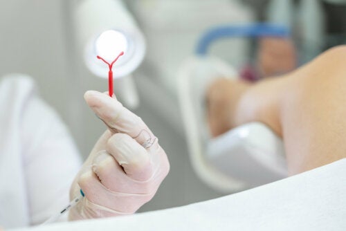 Intrauterinpessar (IUP): Was ist das und wofür wird es verwendet?