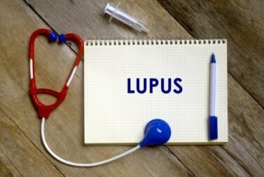 Die Risikofaktoren für Lupus