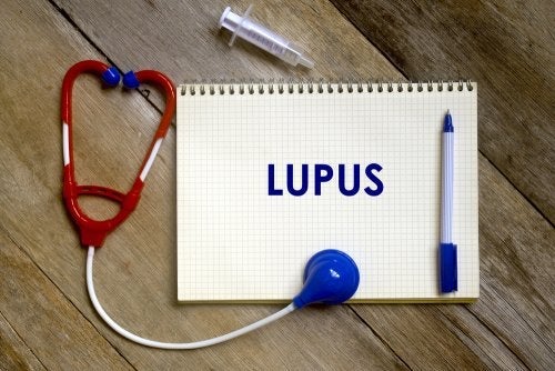 Die Risikofaktoren für Lupus
