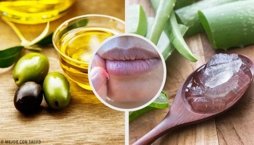 Verbrannte Lippen beruhigen: 6 natürliche Heilmittel